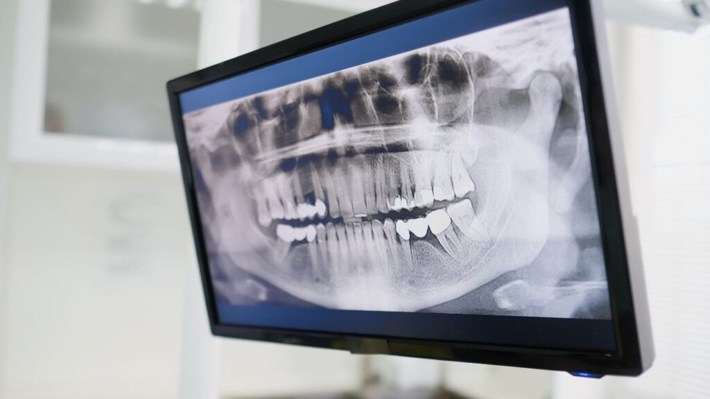 Real-Time Advice for Dental Implant Candidates