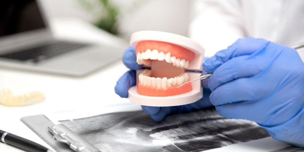 The Benefits of Choosing Dental Implants for Missing Teeth